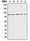 Mediator Complex Subunit 15 antibody, orb215182, Biorbyt, Western Blot image 