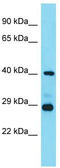 LHFPL Tetraspan Subfamily Member 3 antibody, TA334114, Origene, Western Blot image 