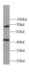 Transcription Termination Factor 1 antibody, FNab08928, FineTest, Western Blot image 