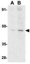 DNA Fragmentation Factor Subunit Alpha antibody, GTX31636, GeneTex, Western Blot image 