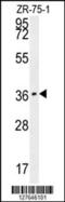 C-Type Lectin Domain Family 12 Member A antibody, 55-016, ProSci, Western Blot image 