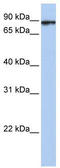 Heat Shock Protein Family A (Hsp70) Member 4 Like antibody, TA335629, Origene, Western Blot image 