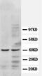 C-C Motif Chemokine Receptor 5 (Gene/Pseudogene) antibody, orb18015, Biorbyt, Western Blot image 