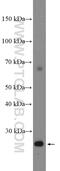 Programmed Cell Death 1 Ligand 2 antibody, 18251-1-AP, Proteintech Group, Western Blot image 