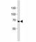 TNF Receptor Superfamily Member 8 antibody, F52777-0.4ML, NSJ Bioreagents, Western Blot image 