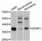 Insulin Like Growth Factor Binding Protein 1 antibody, MBS127446, MyBioSource, Western Blot image 
