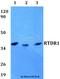 Radial Spoke Head 14 Homolog antibody, A15382, Boster Biological Technology, Western Blot image 