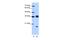 Heterogeneous Nuclear Ribonucleoprotein H3 antibody, A11090, Boster Biological Technology, Western Blot image 