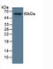 Matrix Metallopeptidase 19 antibody, MBS2028161, MyBioSource, Western Blot image 