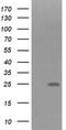 Fibronectin Type III Domain Containing 4 antibody, M15549, Boster Biological Technology, Western Blot image 
