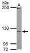 Ubiquitin-protein ligase E3C antibody, NBP2-20790, Novus Biologicals, Western Blot image 