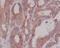 Carcinoembryonic Antigen Related Cell Adhesion Molecule 5 antibody, M00356-1, Boster Biological Technology, Immunohistochemistry paraffin image 