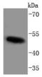 c-Myc antibody, A00026T58S62, Boster Biological Technology, Western Blot image 