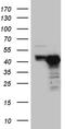 Chitinase Acidic antibody, TA811183, Origene, Western Blot image 