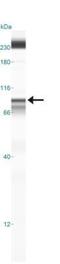 Inhibitor Of Nuclear Factor Kappa B Kinase Subunit Beta antibody, GTX12140, GeneTex, Western Blot image 
