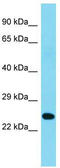 Chromosome 2 Open Reading Frame 49 antibody, TA330727, Origene, Western Blot image 