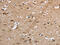 Endosome Associated Trafficking Regulator 1 antibody, CSB-PA037904, Cusabio, Immunohistochemistry paraffin image 