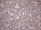 AlkB Homolog 1, Histone H2A Dioxygenase antibody, M06945, Boster Biological Technology, Immunohistochemistry paraffin image 