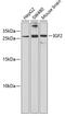 Insulin Like Growth Factor 2 antibody, GTX55671, GeneTex, Western Blot image 