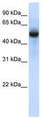 TRNA Methyltransferase 2 Homolog B antibody, TA346837, Origene, Western Blot image 