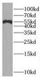 RAD23 Homolog A, Nucleotide Excision Repair Protein antibody, FNab07077, FineTest, Western Blot image 