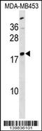 Lysophospholipase 1 antibody, 60-299, ProSci, Western Blot image 