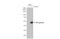 Transcription Factor AP-2 Gamma antibody, GTX134259, GeneTex, Western Blot image 