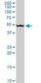 Beta-Ureidopropionase 1 antibody, H00051733-M09, Novus Biologicals, Western Blot image 