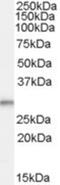 TPD52 Like 2 antibody, NBP1-06092, Novus Biologicals, Western Blot image 