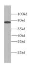 Tetratricopeptide Repeat Domain 39A antibody, FNab09085, FineTest, Western Blot image 