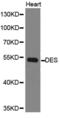 Desmin antibody, abx000692, Abbexa, Western Blot image 