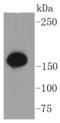 Structural maintenance of chromosomes protein 1A antibody, A02148S957-2, Boster Biological Technology, Western Blot image 