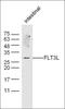 Fms Related Tyrosine Kinase 3 Ligand antibody, orb156903, Biorbyt, Western Blot image 