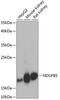 NADH dehydrogenase [ubiquinone] 1 beta subcomplex subunit 5, mitochondrial antibody, 23-513, ProSci, Western Blot image 