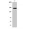 ATP Binding Cassette Subfamily C Member 12 antibody, LS-C381845, Lifespan Biosciences, Western Blot image 