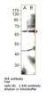 EH Domain Containing 1 antibody, MBS540380, MyBioSource, Western Blot image 