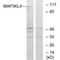 Mitogen-Activated Protein Kinase Kinase Kinase 21 antibody, A10572, Boster Biological Technology, Western Blot image 
