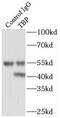 TATA-box-binding protein antibody, FNab08525, FineTest, Immunoprecipitation image 