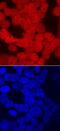 Amnion Associated Transmembrane Protein antibody, PA5-47897, Invitrogen Antibodies, Immunocytochemistry image 