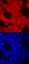 Amnion Associated Transmembrane Protein antibody, PA5-47897, Invitrogen Antibodies, Immunocytochemistry image 