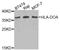 Major Histocompatibility Complex, Class II, DO Alpha antibody, abx006404, Abbexa, Western Blot image 