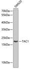 Tachykinin Precursor 1 antibody, GTX66407, GeneTex, Western Blot image 