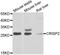 Cysteine Rich Secretory Protein 2 antibody, A7177, ABclonal Technology, Western Blot image 