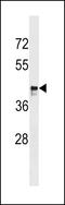  antibody, LS-C158100, Lifespan Biosciences, Western Blot image 