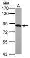 HPS6 Biogenesis Of Lysosomal Organelles Complex 2 Subunit 3 antibody, GTX116845, GeneTex, Western Blot image 