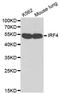 Interferon Regulatory Factor 4 antibody, orb48971, Biorbyt, Western Blot image 