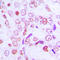 Cyclin G1 antibody, GTX55852, GeneTex, Immunohistochemistry paraffin image 