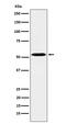 Protein Kinase CAMP-Dependent Type II Regulatory Subunit Alpha antibody, M03911-4, Boster Biological Technology, Western Blot image 