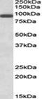 PR/SET Domain 16 antibody, orb20352, Biorbyt, Western Blot image 