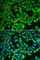 Proteasome 26S Subunit, Non-ATPase 7 antibody, A5356, ABclonal Technology, Immunofluorescence image 